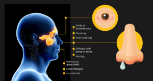 Read more about the article Frequent rhinitis: matter of concern.