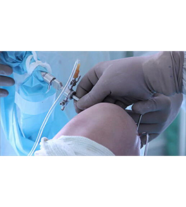 ARTHROSCOPY
