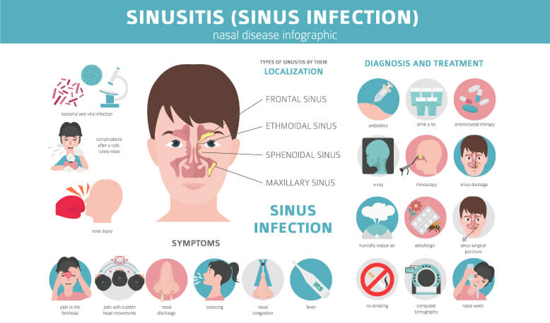 sinuses ventilated: FESS